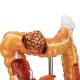 Nasco MG35589 Colon and Rectum with Intestinal Pathologies Model - Angle 3 Close-up