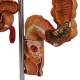 Nasco MG35589 Colon and Rectum with Intestinal Pathologies Model - Angle 1 Close-up
