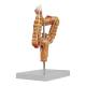 Nasco MG35589 Colon and Rectum with Intestinal Pathologies Model - Right Angle