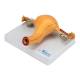 Nasco MG36026 Uterus with Ovary Model, 2 Parts - Left Angle Assembled