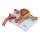 Nasco MG36026 Uterus with Ovary Model, 2 Parts - Left Angle Disassembled