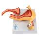 Nasco MG36026 Uterus with Ovary Model, 2 Parts - Side View
