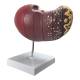 Nasco MG36148 Liver Section with Pathology Model - Back View