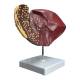Nasco MG36148 Liver Section with Pathology Model - Right Angle