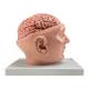 Nasco MG36150 Brain with Arteries Model, 9 Parts - Angle 3