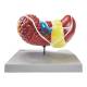 Nasco MG36908 Liver Section with Pathologies Model - Back view