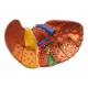 Nasco MG36908 Liver Section with Pathologies Model - Close-up