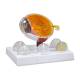 Nasco MG38396 Eye with Cataract Model