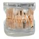 Nasco MG38398 Translucent Adult Dentition Normal and Pathology Model - Fron View