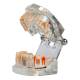 Nasco MG38398 Translucent Adult Dentition Normal and Pathology Model - 45 Degrees Opened
