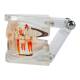 Nasco MG38398 Translucent Adult Dentition Normal and Pathology Model - Pathology Side