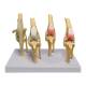Nasco MG38400 Canine Osteoarthritis Knee Model - Angle 1