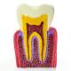 Nasco MG39442 Dental Disease Model, 6x Enlarged - Front View Normal