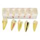 Nasco MG39443 Endodontics Dental Model, 5 Parts - Disassembled