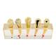 Nasco MG39443 Endodontics Dental Model, 5 Parts - Front View