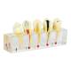 Nasco MG39443 Endodontics Dental Model, 5 Parts - Left Angle