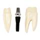 Nasco MG39444 Dental Implant Model, 8 Parts - Angle 5