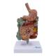 Nasco MG39708 Gastrointestinal Tract with Pathologies Model