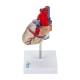 Nasco MG7330 Transparent Heart with Conductive System Model, Left Side View