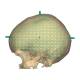 RSD RS-MMH Multi-Modality Fusion Head Phantom - Clinical Image Skull
