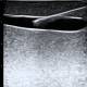 SurgMate VAP-B01 Vascular Access Phantom - Adult Version, Horizontal Ultrasound