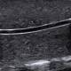 SurgMate VAP-B03 Vascular Access Phantom - Pediatric Version, Curved Vessel Ultrasound View