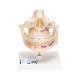 3B Scientific VE281 Adult Denture Model - 3B Smart Anatomy