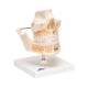 3B Scientific VE281 Adult Denture Model - 3B Smart Anatomy