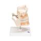 3B Scientific VE281 Adult Denture Model - 3B Smart Anatomy