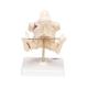 3B Scientific VE281 Adult Denture Model - 3B Smart Anatomy