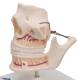 3B Scientific VE281 Adult Denture Model - 3B Smart Anatomy