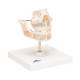 3B Scientific VE282 Milk Dentures Model - 3B Smart Anatomy