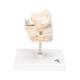3B Scientific VE282 Milk Dentures Model - 3B Smart Anatomy
