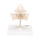 3B Scientific VE282 Milk Dentures Model - 3B Smart Anatomy