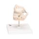 3B Scientific VE282 Milk Dentures Model - 3B Smart Anatomy
