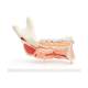 3B Scientific VE290 Advanced Half Lower Jaw with 8 Diseased Teeth 19-Part - 3B Smart Anatomy