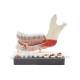 3B Scientific VE290 Advanced Half Lower Jaw with 8 Diseased Teeth 19-Part - 3B Smart Anatomy