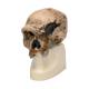 3B Scientific VP753-1 Anthropological Skull Model - Steinheim