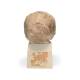 3B Scientific VP753-1 Anthropological Skull Model - Steinheim