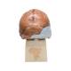 3B Scientific VP754-1 Anthropological Skull Model - Broken Hill or Kabwe