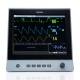 Edan X12 Patient Monitor with 12" Touch Screen and WiFi