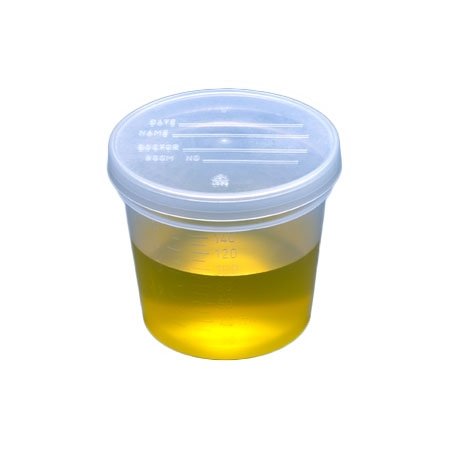 5oz Graduated Urine Collection Container with Snap Cap Non-Sterile Globe  5917