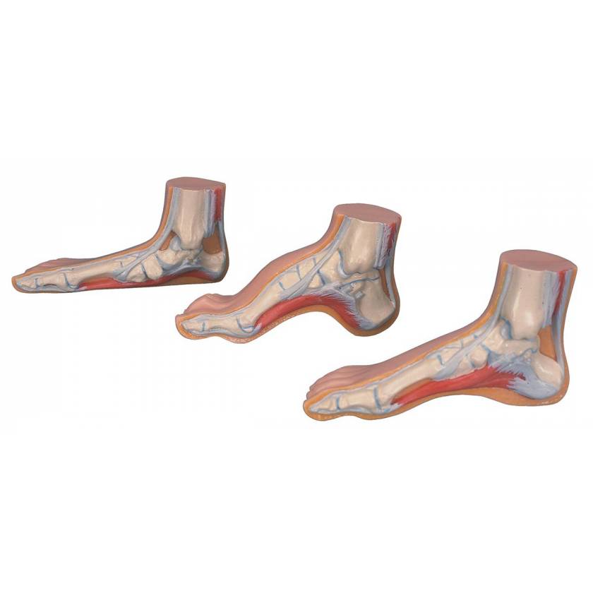 3B Scientific MAM33 MedArt Normal Flat and Hollow Feet