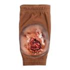 STOPS Medical 1025870 Brachial Wound Sleeve - Dark Skin Tone