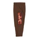 STOPS Medical 1025978 Radial/Ulna Open Fracture Sleeve - Dark Skin Tone