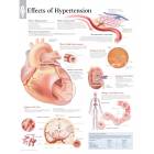 Effects of Hypertension Chart