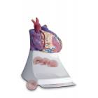 Scientific Publishing 1454M Life Size Diseased Heart Model