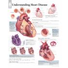 Understanding Heart Disease Chart