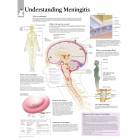Scientific Publishing Understanding Meningitis Chart