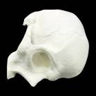 Bone Models™ 200800 Half Skull Surgical Practice Model, Front View